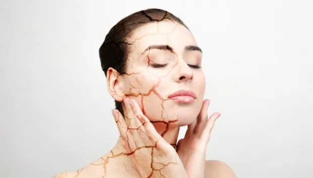 Tips Merawat dan Mengatasi Kulit Kering